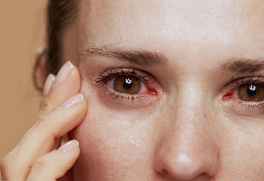 Trockene Augen – Ursachen, Symptome & Behandlung